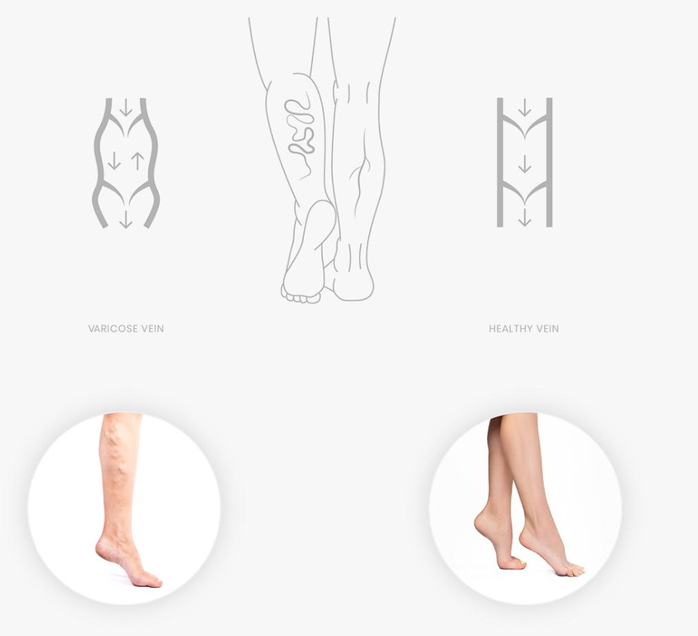 ViH血管醫學私人診所品牌識別logo設計，皇家深藍色和玫瑰色膚色